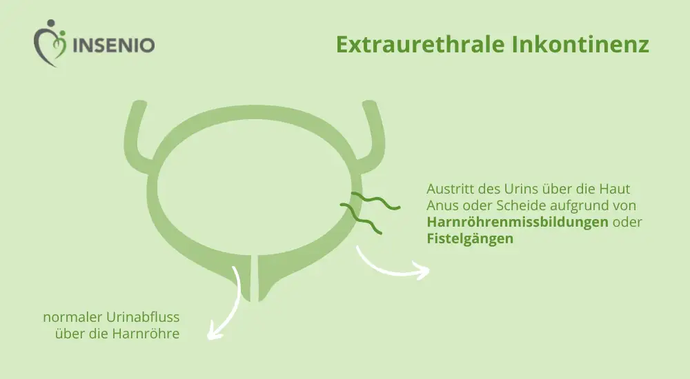 Infografik Extraurethrale Inkontinenz